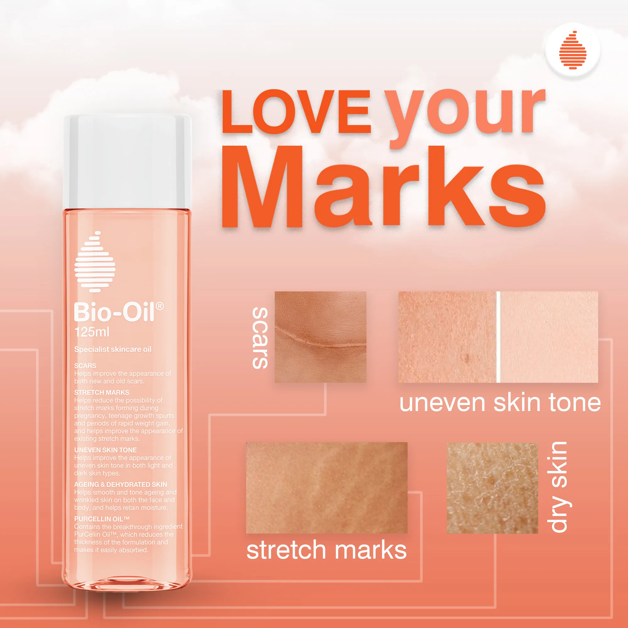 Bio-Oil Love your Marks post